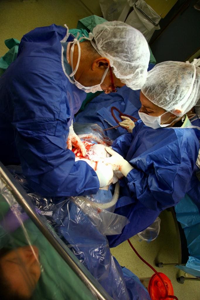 מנתחים קיסרי בחדר ניתוח בבית חולים ליס