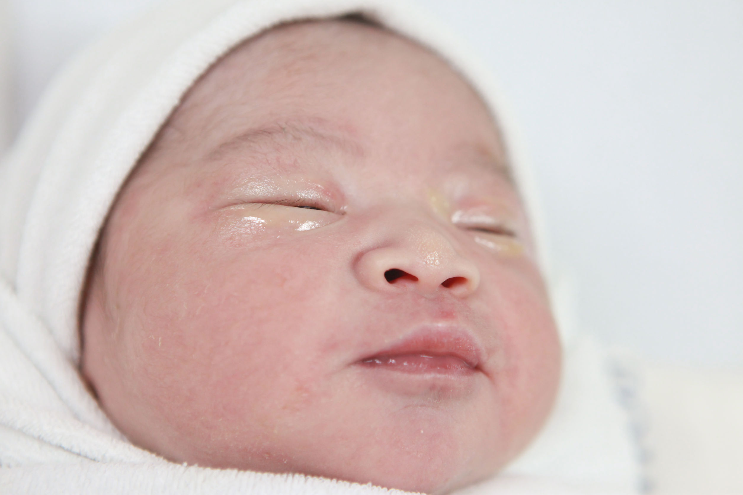 תינוק שנולד בקיסרי חירום
