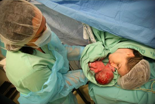 פגישה ראשונה עם התינוק אחרי ניתוח קיסרי