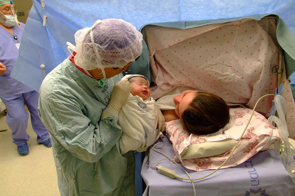יולדת בקיסרי פוגשת לראשונה את התינוק בחדר הניתוח